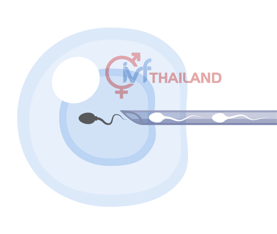 IVF-TAI-THAILAND