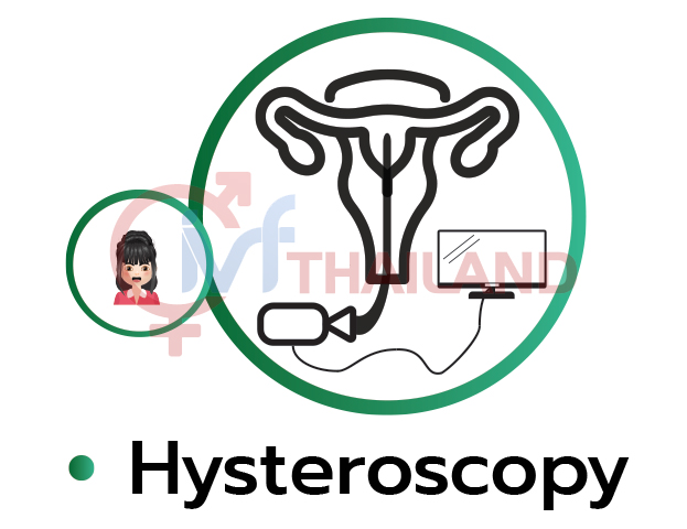 NOI SOI BUONG TU CUNG