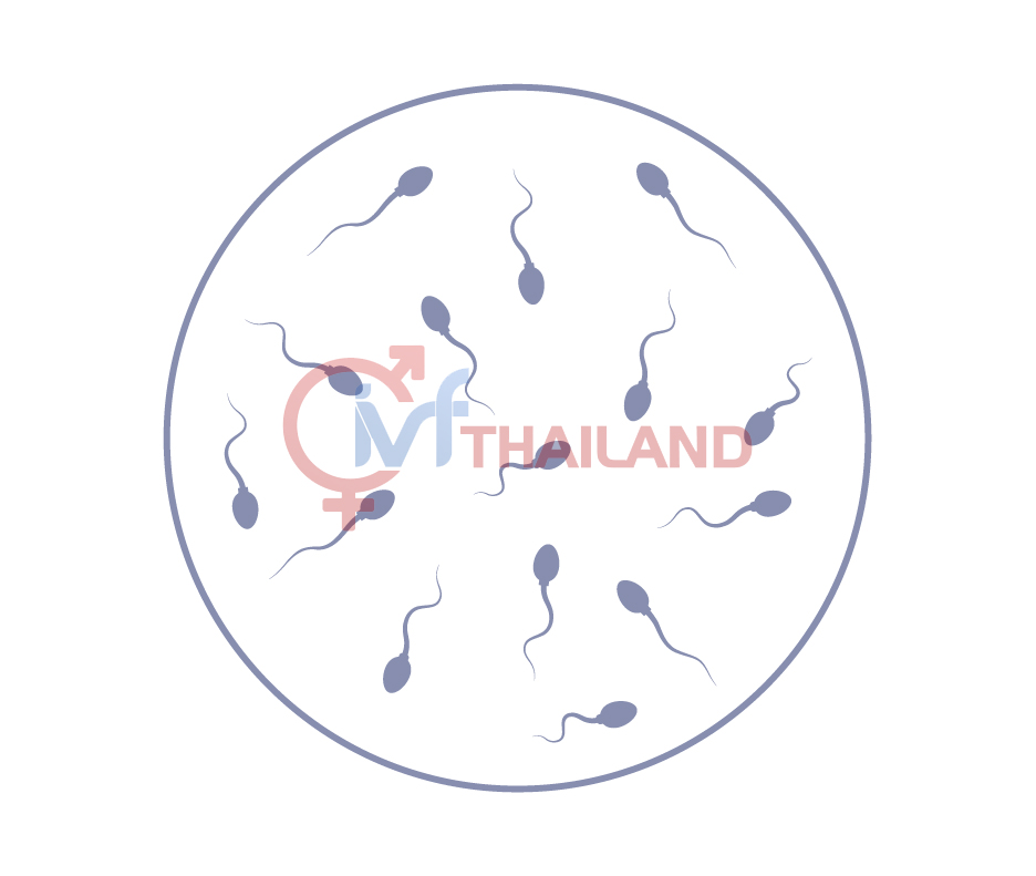 PHÂN TÍCH TINH DỊCH ĐỒ TẠI THAILAND (Sperm Analysis) 1 PHAN TICH TINH DICH DO TAI THAI LAN