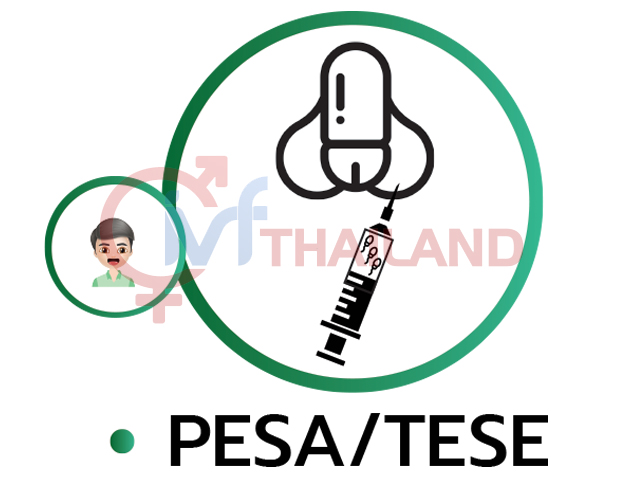 THU THẬP TẾ BÀO TINH TRÙNG TRỰC TIẾP TỪ TINH HOÀN